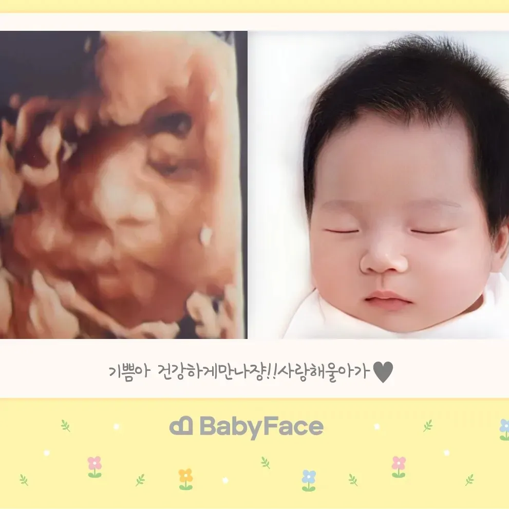 베이비페이스했어요!!!