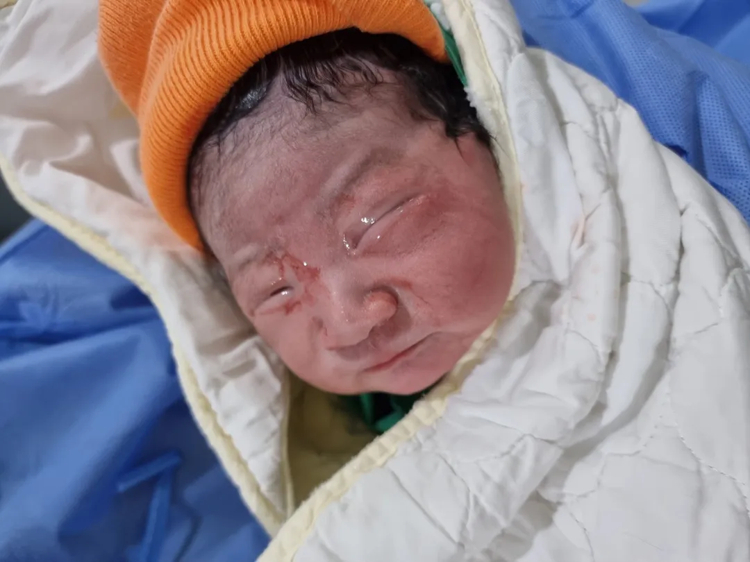 38주5일 무통없이 자연분만 시도+응급제왕 후기(긴글주의)