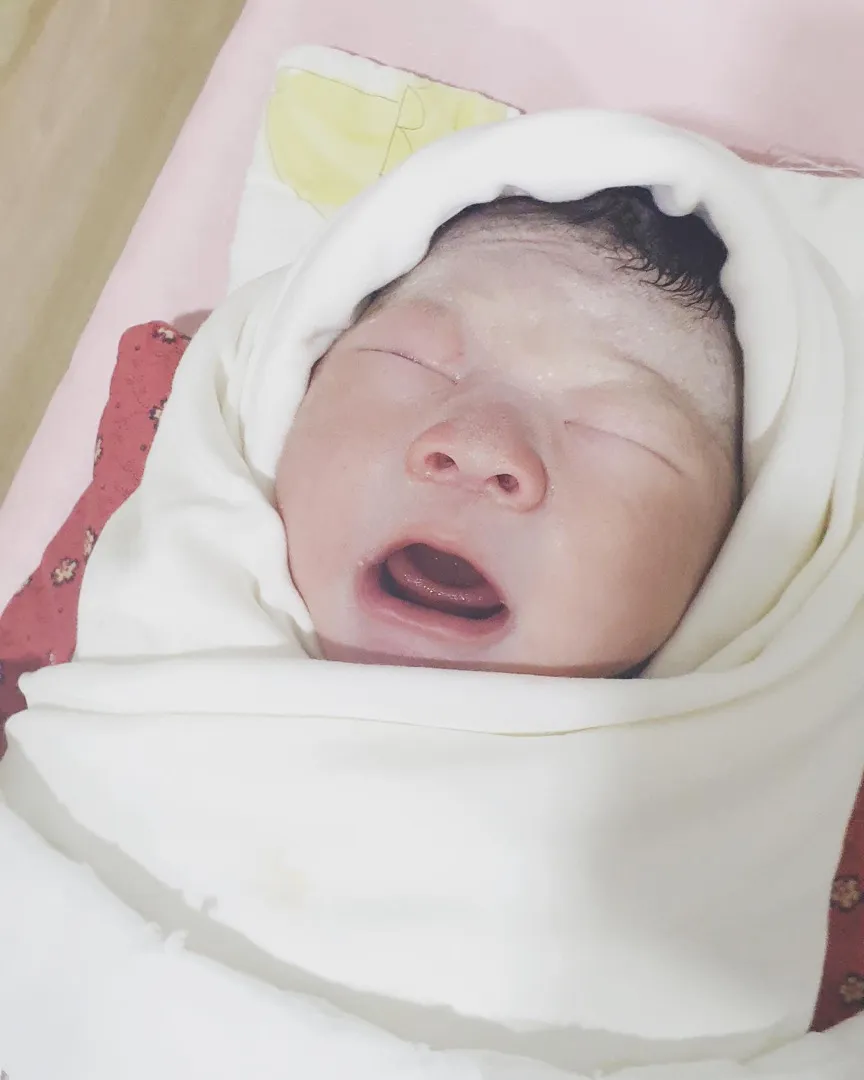 오늘 수술로 아기 만났어요!!