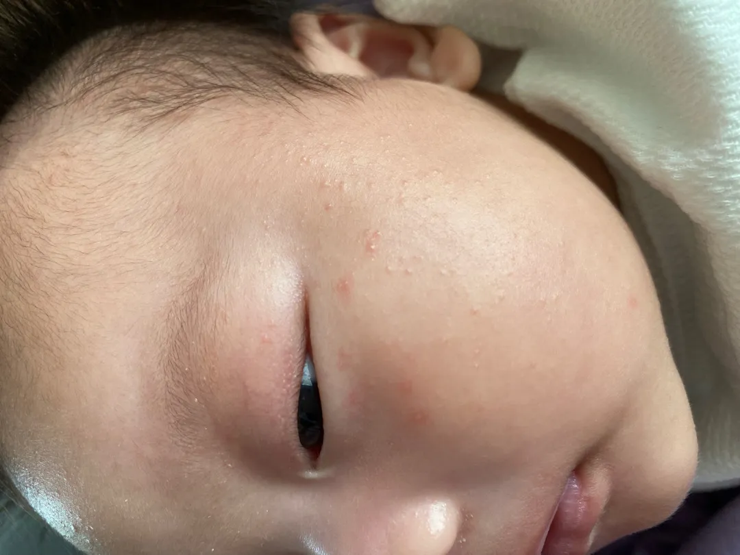 사진 봐주세요 ㅠㅠ 아기피부에 뭐가 낫어요 ㅠㅠ