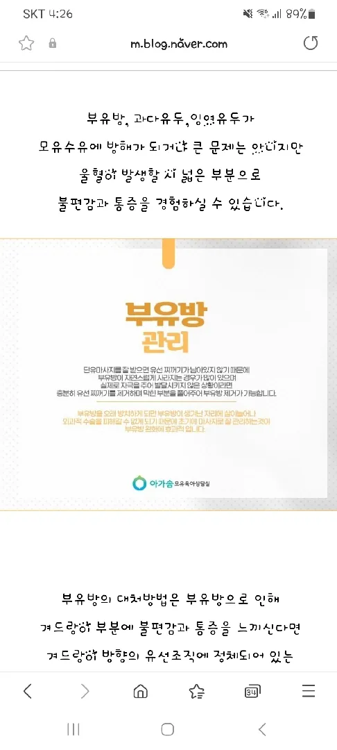 부유방 생기는 원인은 단유하고 단유마사지 안 받아서 그럴까요?