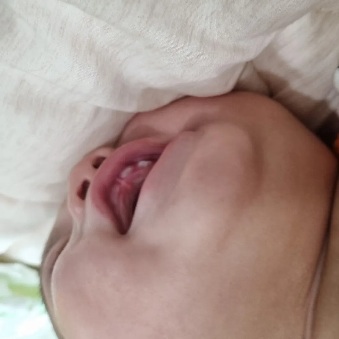 공포의이앓이 2