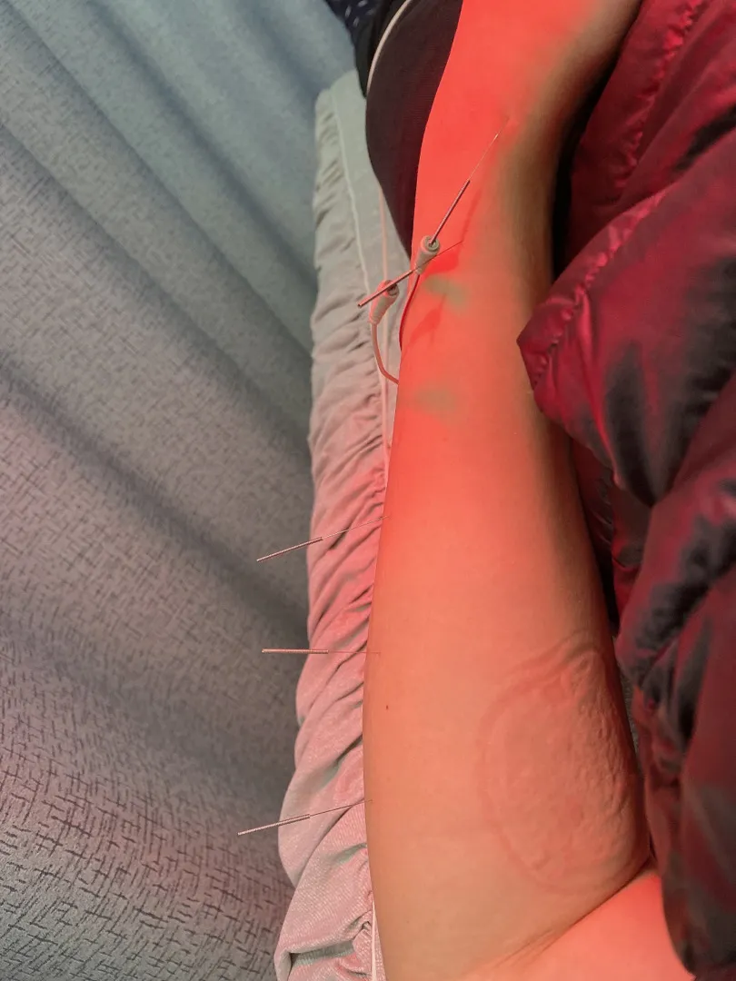 손목... 건초염ㅠㅠ