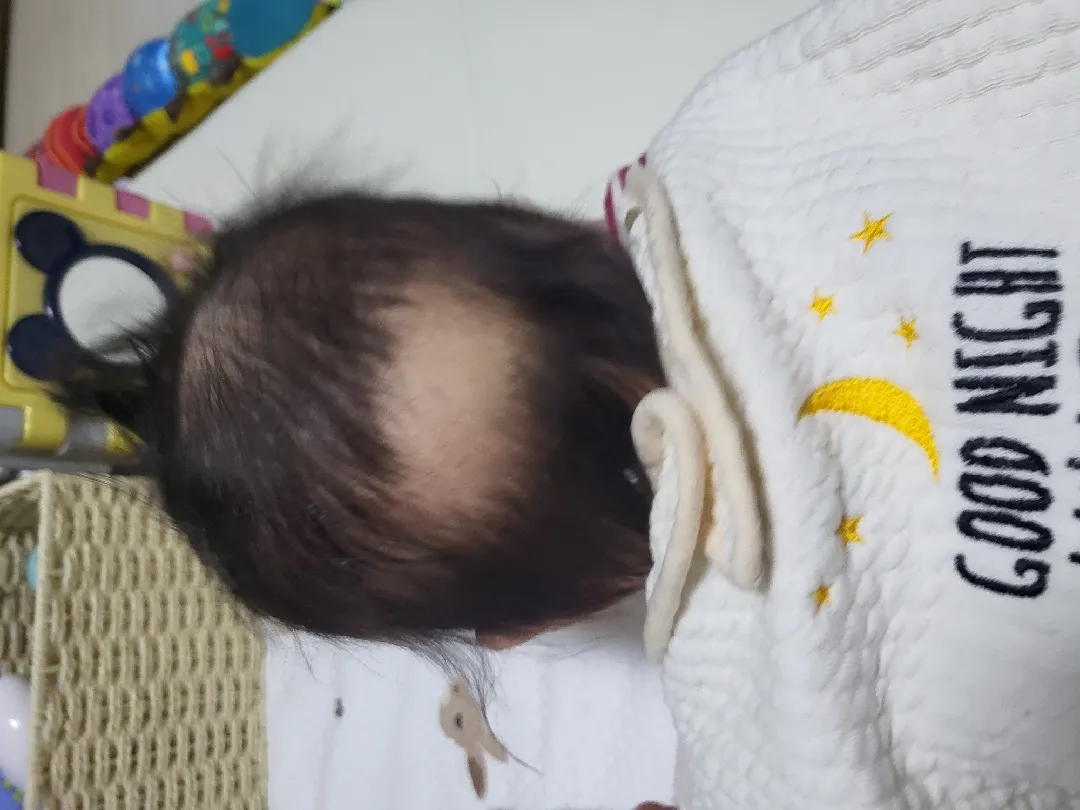 저희아이보다머리마니비는아이잇을까용?ㅋㅋ