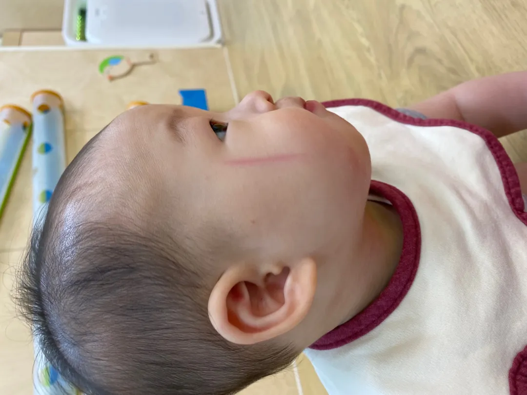 얼굴 상처가 ㅜㅜㅜ