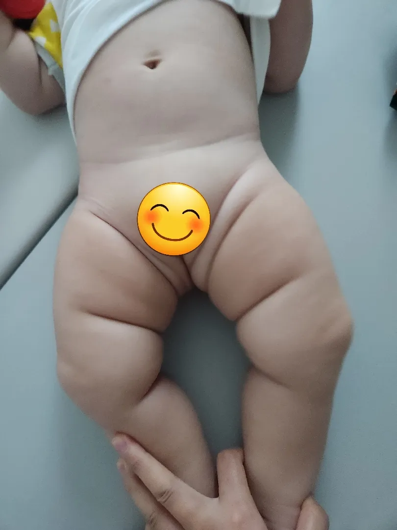 아기 다리주름 
