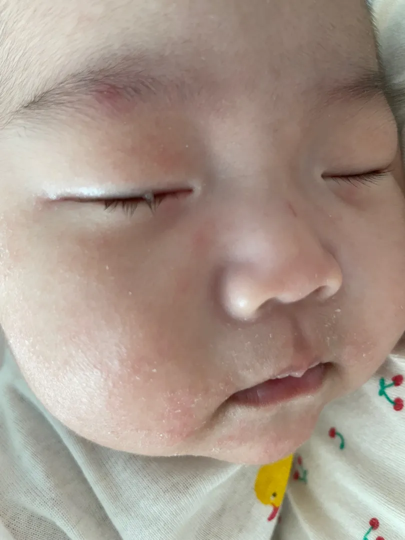 침독일까요?