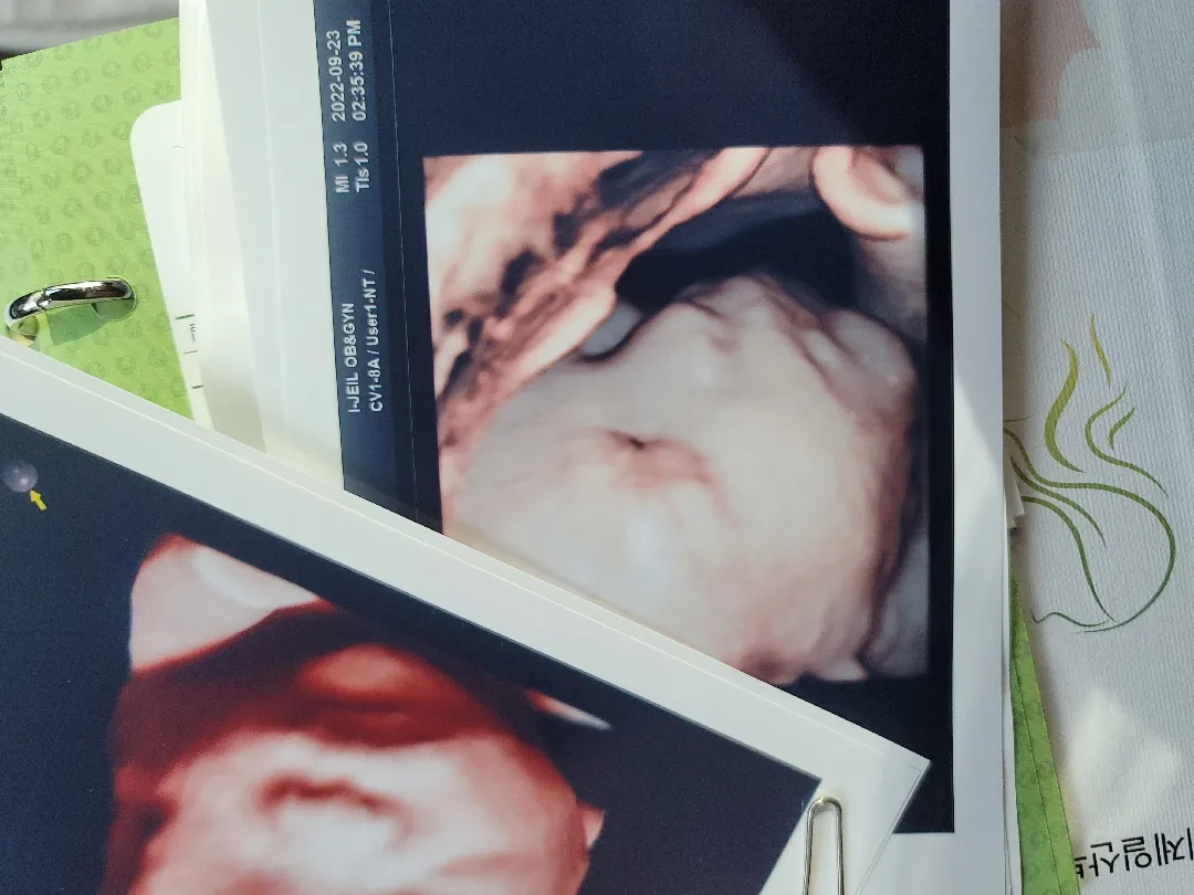 저도 한번 올려봅니다.. 입체춈파..🤗