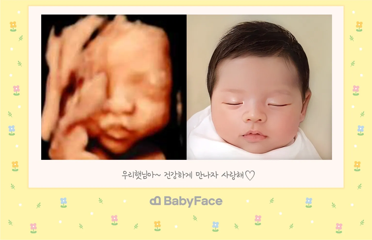 저도 베이비페이스 했어요!!