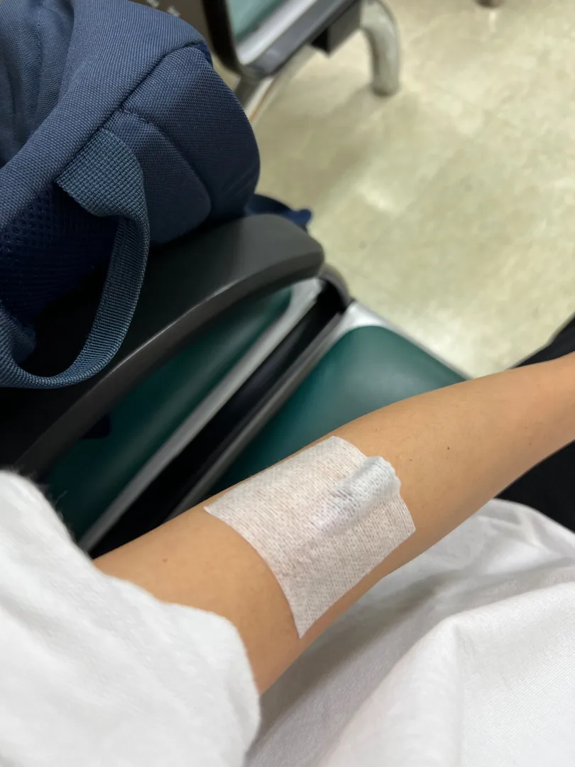 임당 재검하러 왔어요