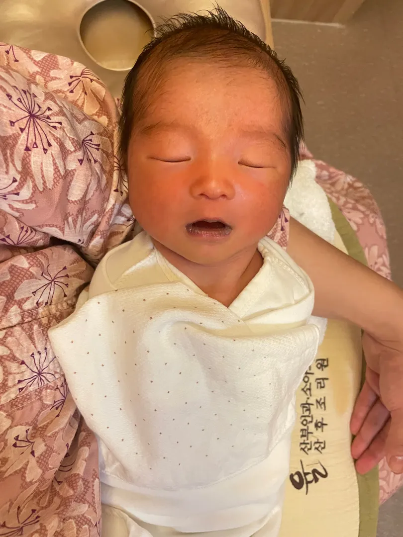 청색증? 헷갈려요..
