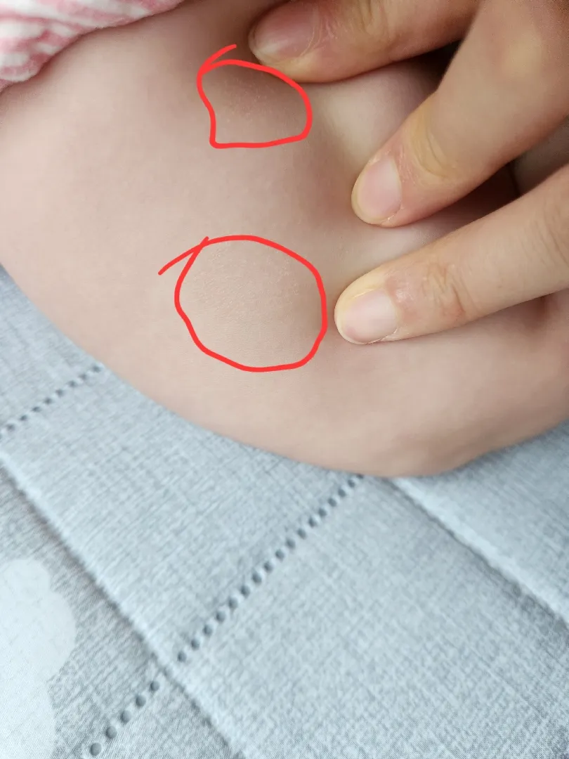 아기 피부가 건조한지 상태 한번 봐주세오 -!