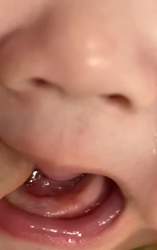 이 나오려는걸까요?
