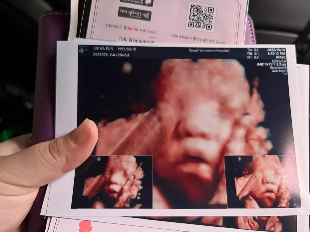 초음파 보고 왔는데
