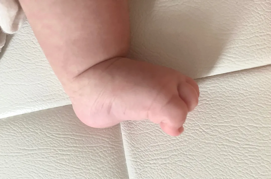 발가락 왜 이렇게 하는걸까요?