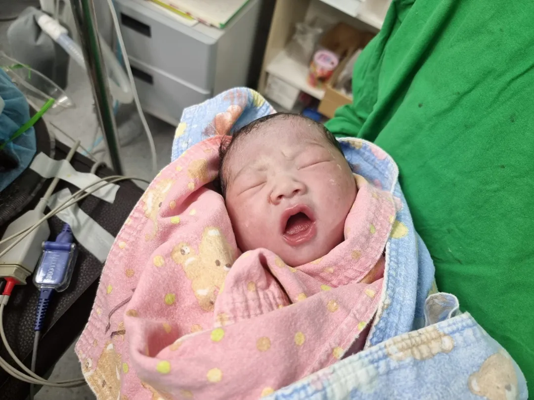 37주 6일 제왕절개 출산했어요 !