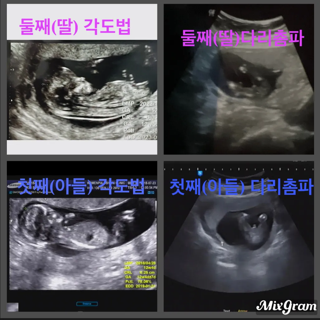 [도움이되길요!]첫째 아들, 둘째 딸 촘파 공유해요~ 