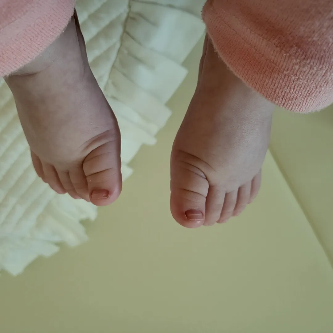 저희집 애기 발톱 좀 봐주세요~