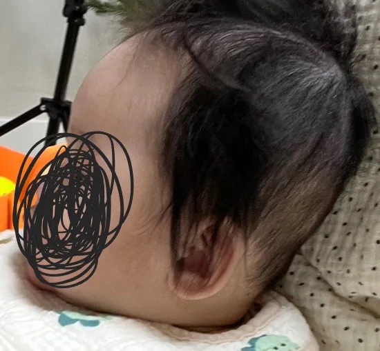 아기 두상 좀 봐주세요 ㅠㅠ