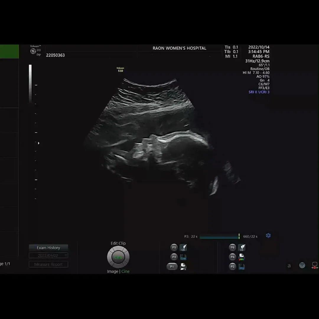 community post image