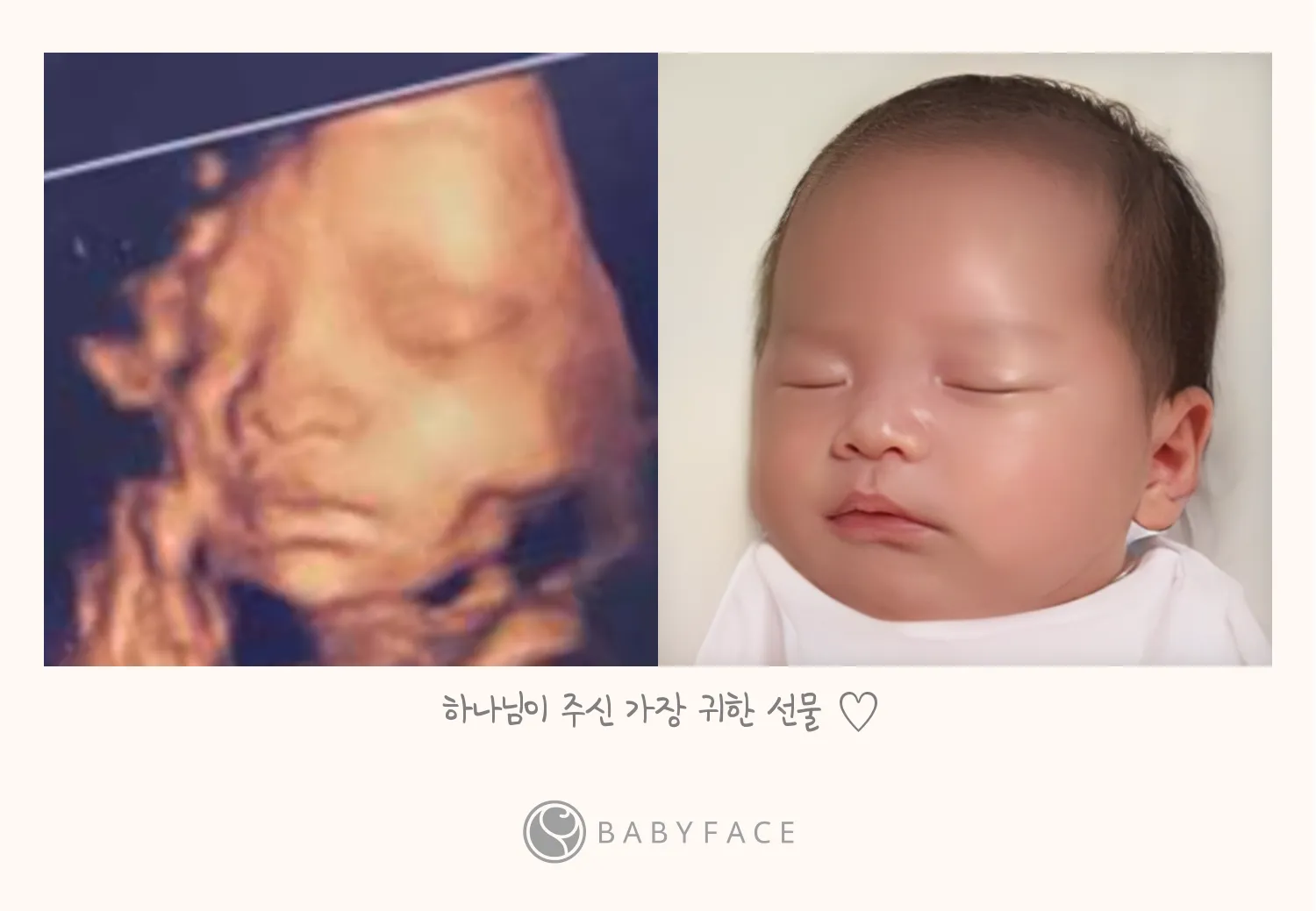 저도 베이비페이스 했어요!