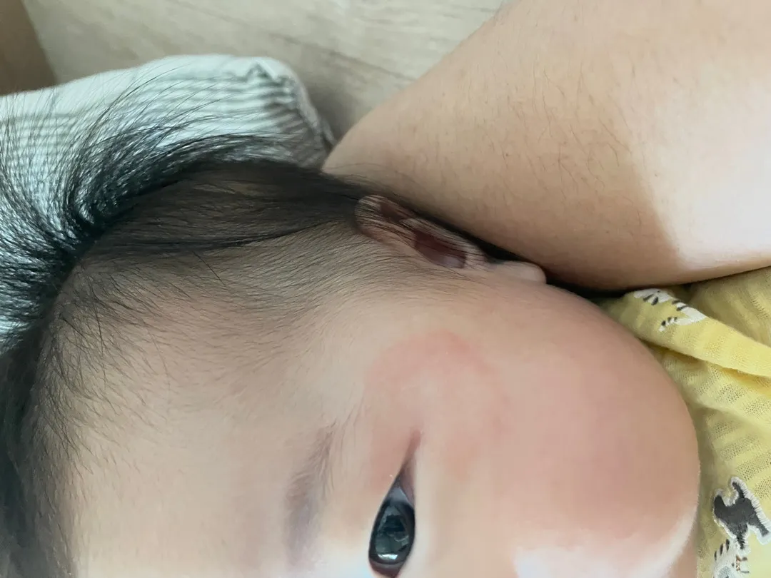 아기피부 한번 봐주세요 ㅠ