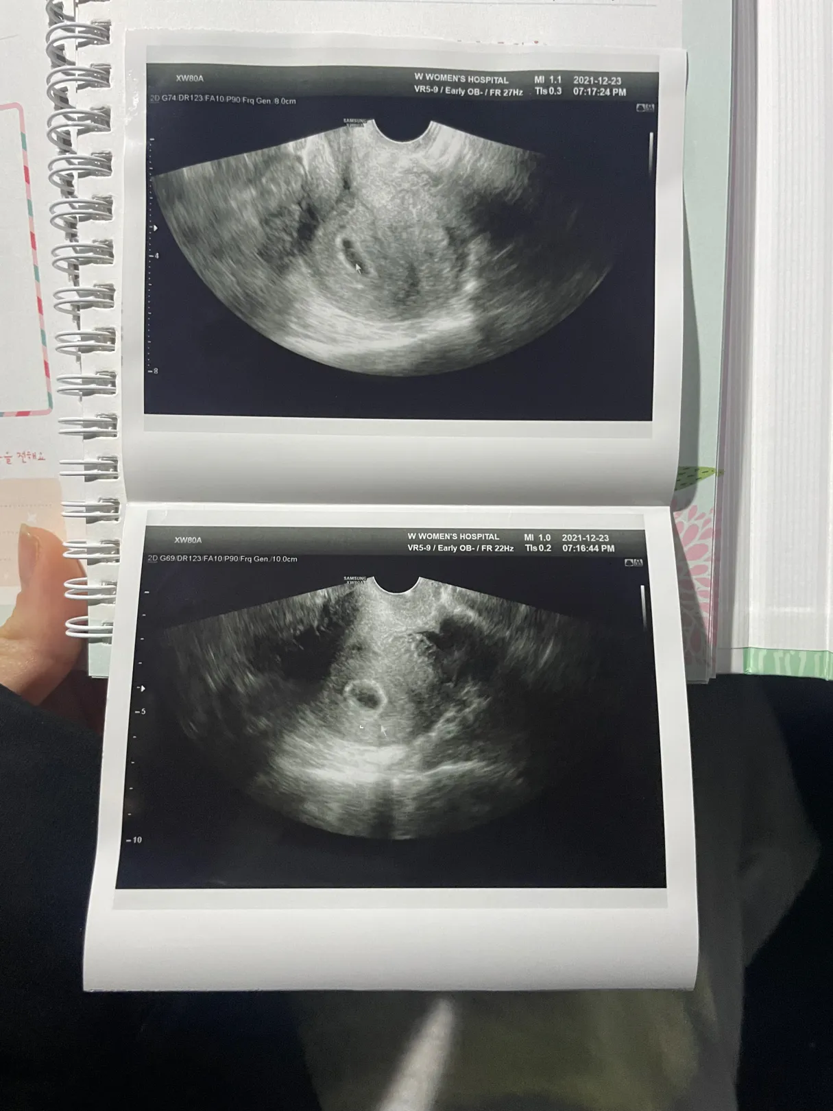 딱 6주차때 보고온 👶🏻