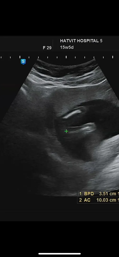 15주 6일차! 다리 사이 봐주세요 ㅎㅎ