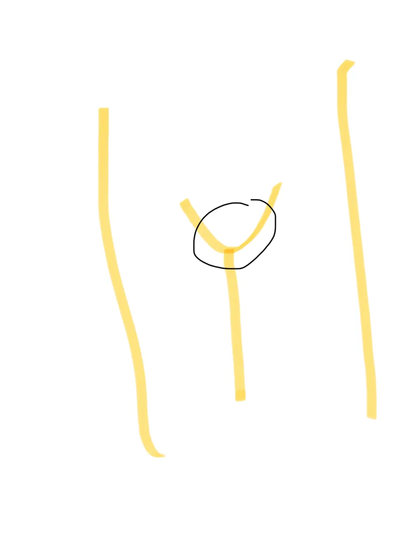 community post image