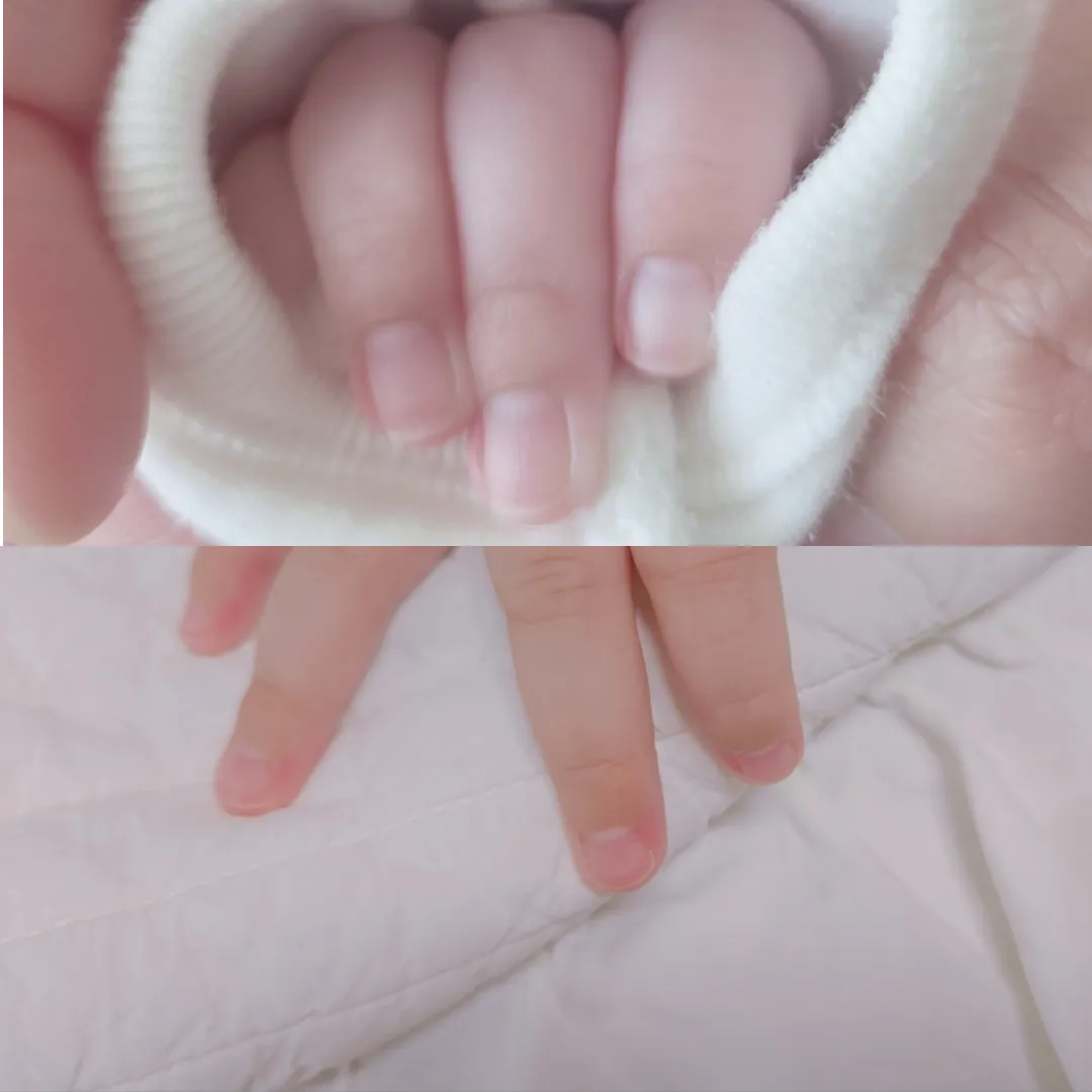 아기 손톱