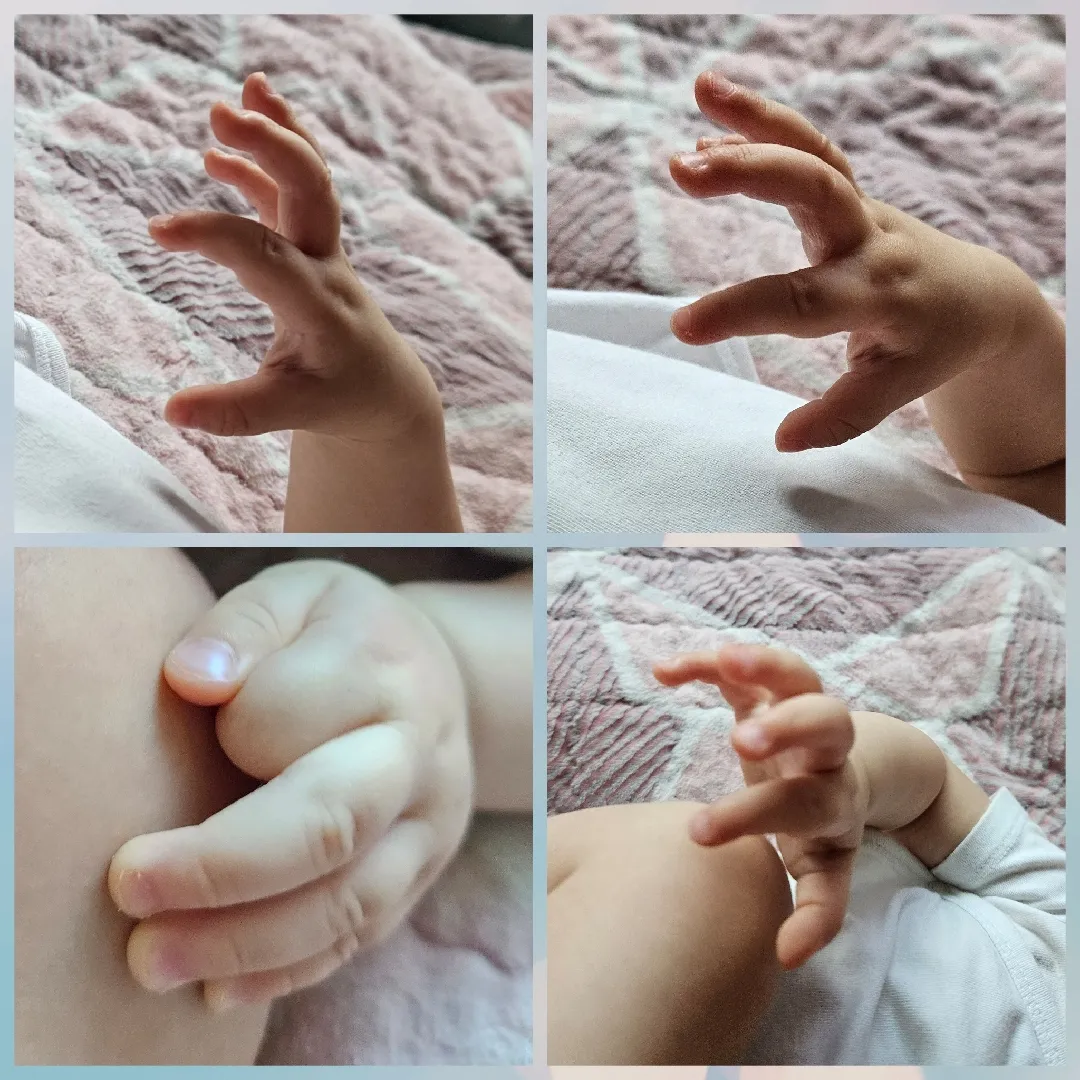 두번째손가락 사진봐주세용ㅠ_ㅠ