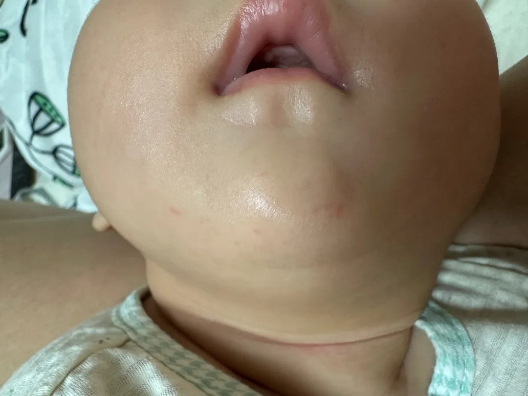 침독인지 봐주세요