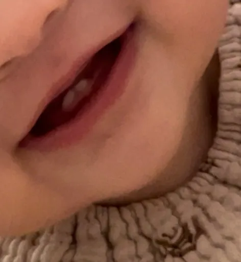 치아크기