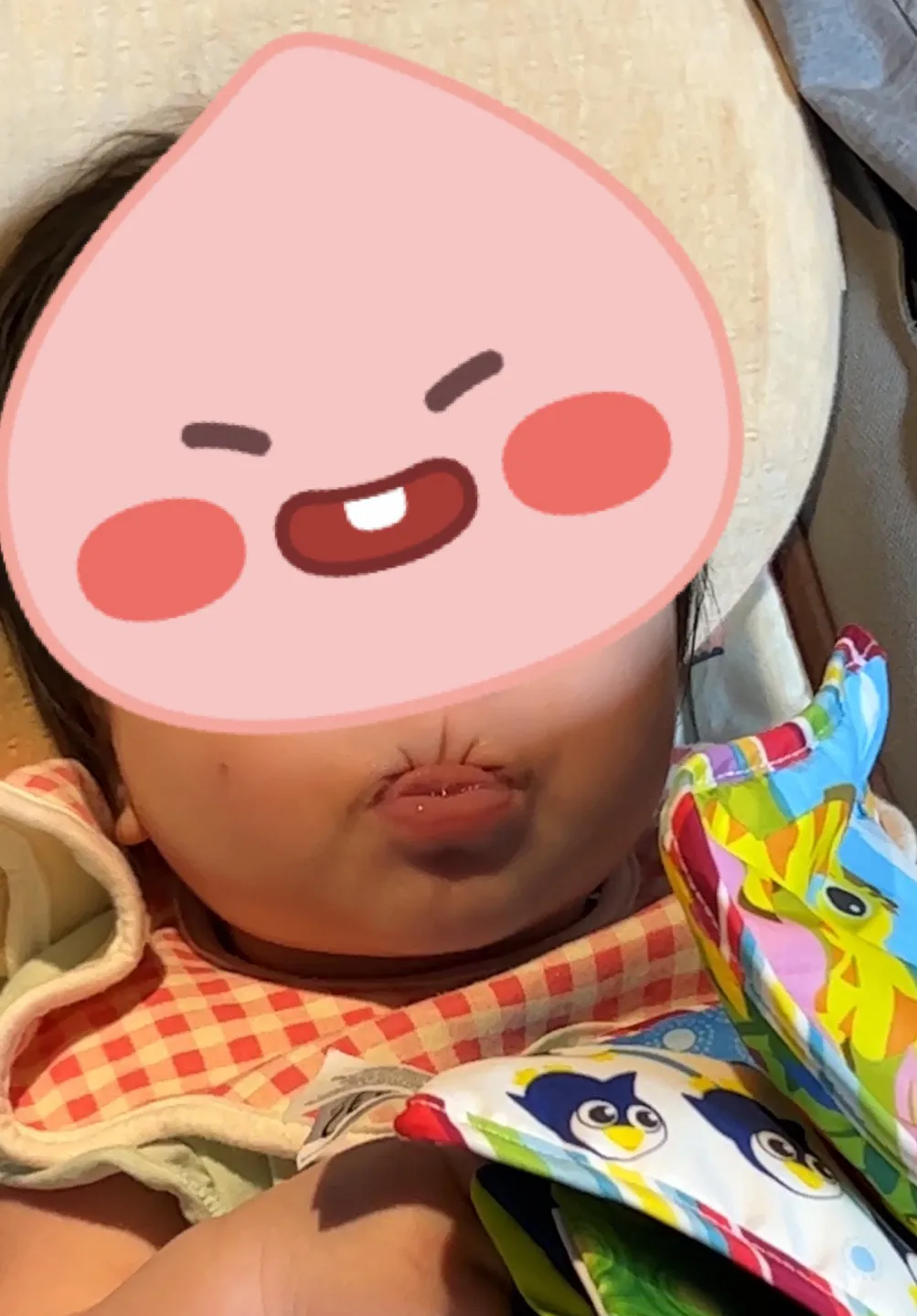 윗입술 빨기