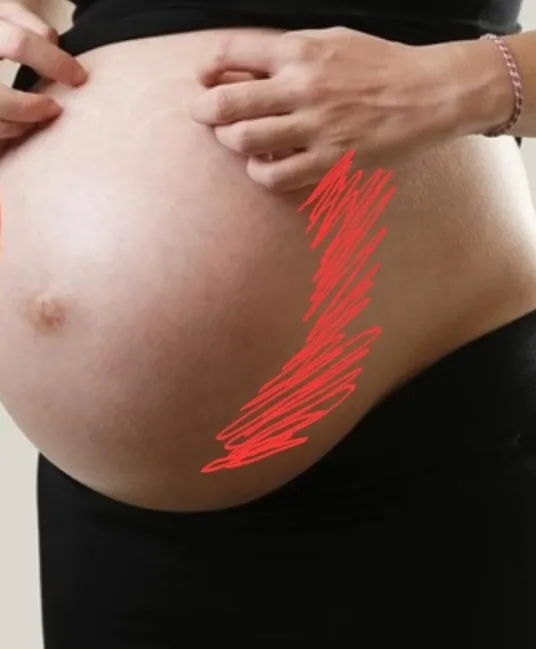community post image
