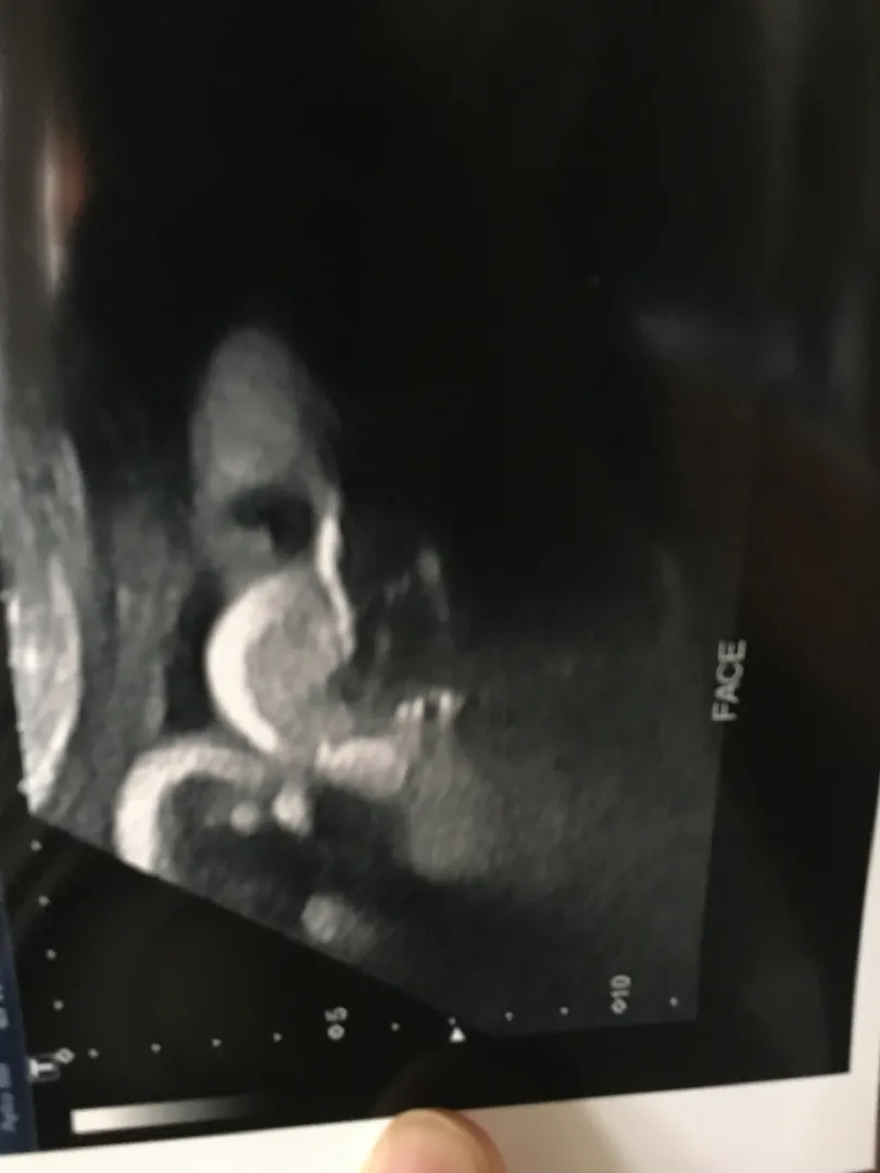 35주 6일, 아기는 3.3kg 래요 😂