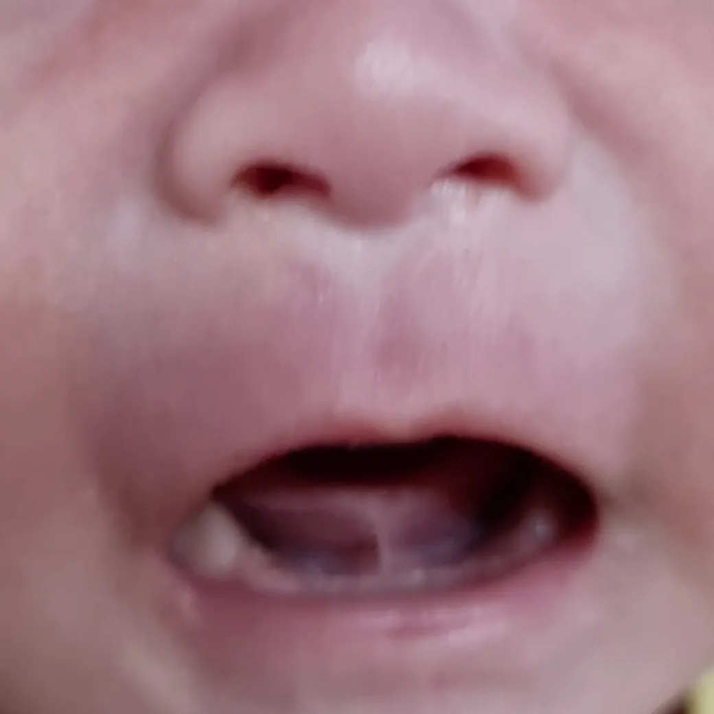 애기 설소대 봐주세요...ㅠㅠ