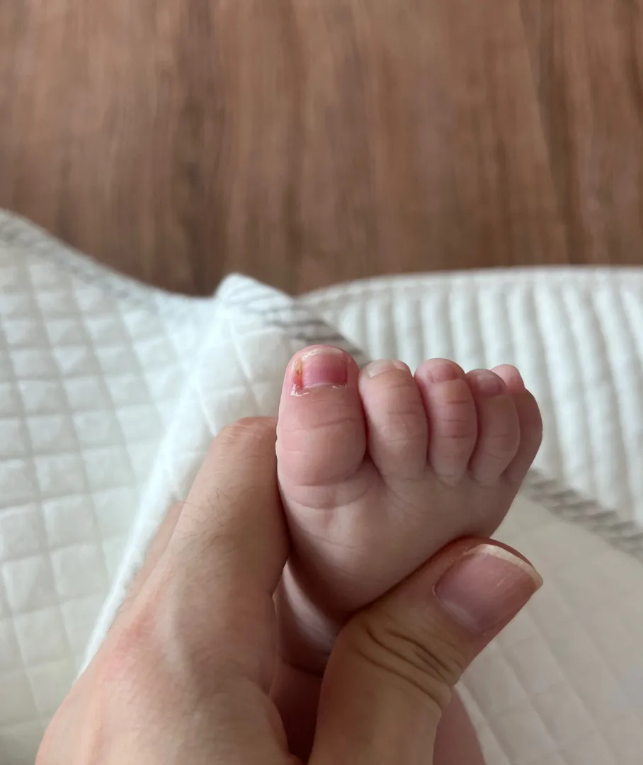 아기 발가락좀 봐주세요 ㅠㅠ