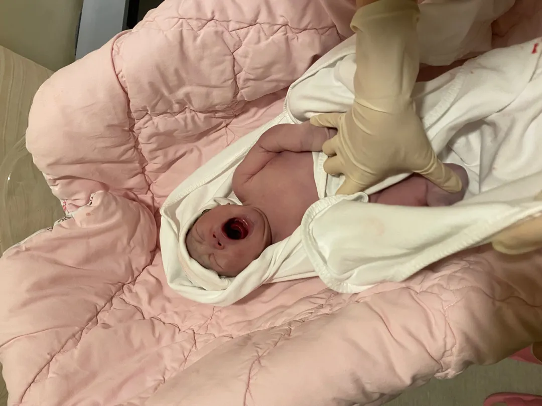 37주5일차 갑자기 방뺐어요 👶🏻❤️