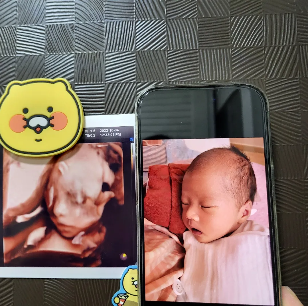 초음파 사진이랑 똑같네요ㅋㅋ