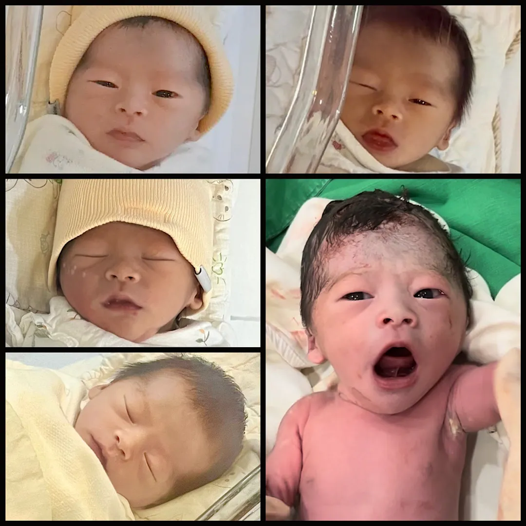 개구리를 낳았어요🤣🐸💚