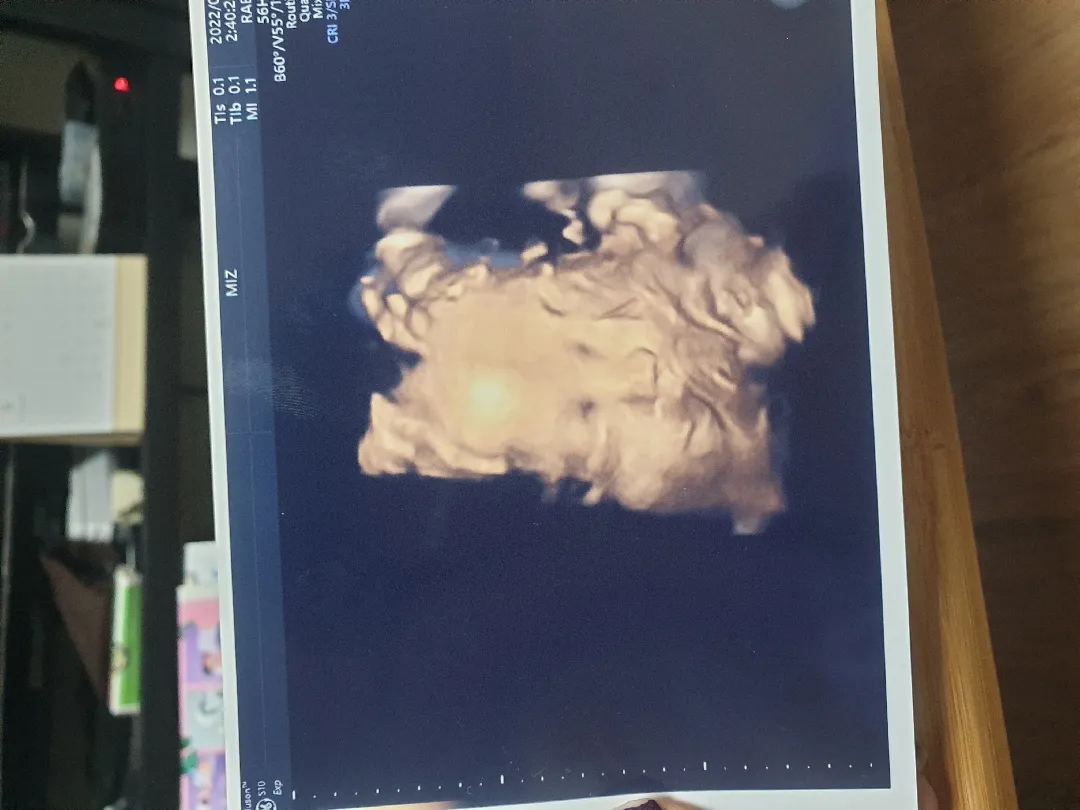 28주6일차..드디어 보는아기얼굴~!