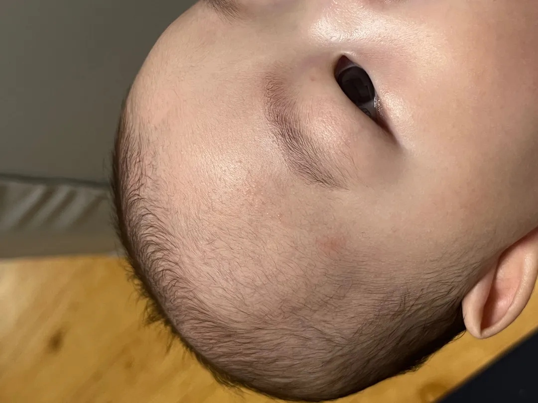 피부에 오돌토돌한게 뭘까요? ㅠ