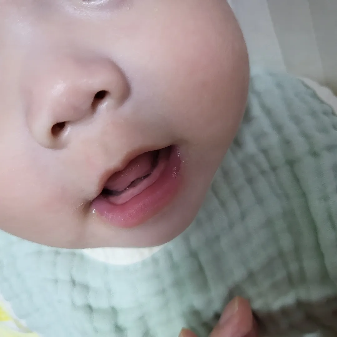 이앓이? 원더윅스? 