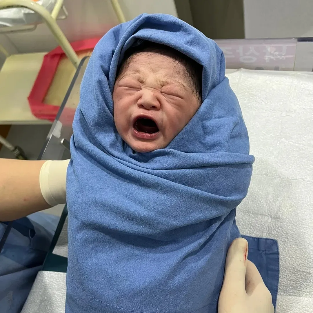 오늘 제왕으로 출산했어요