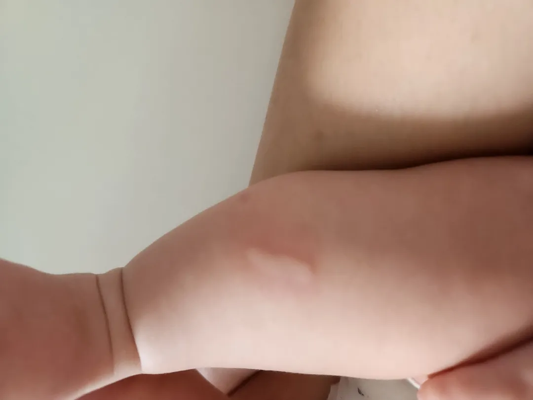 아기 피부 이거 뭘까요ㅠ