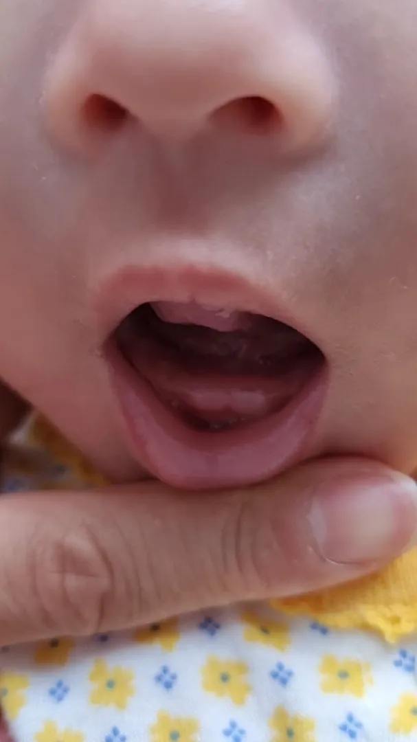 이거 이나는거 일까요?