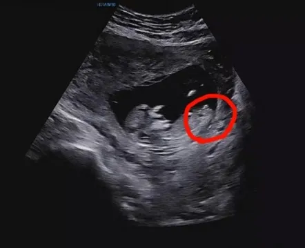 각도법 보실 줄 아시나요?