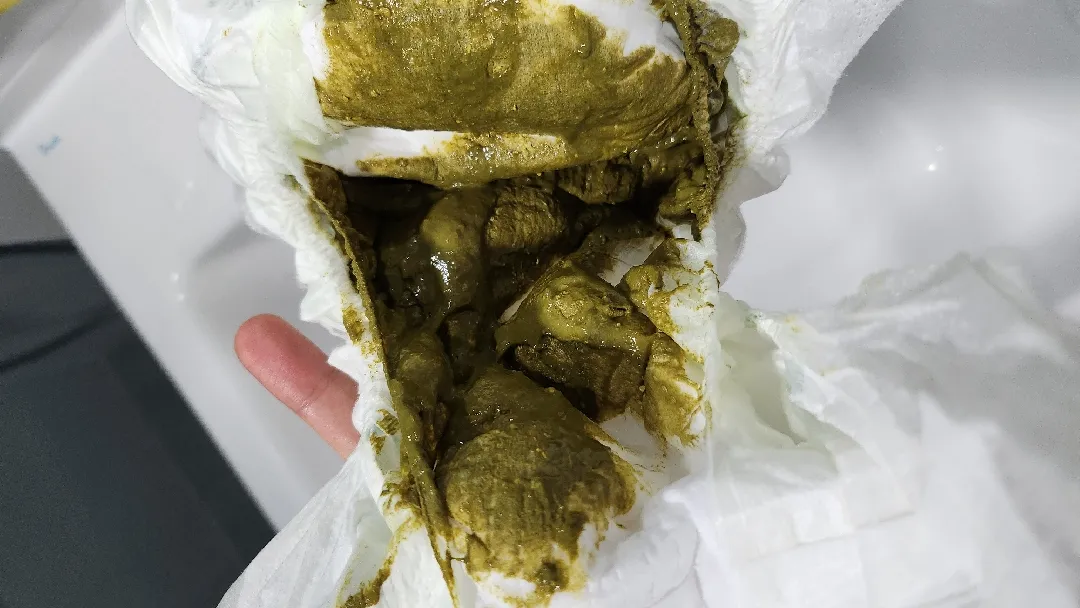 녹변.. 분유 바꿔야할까요...?(이미지첨부!! 주의해주세용!!!)