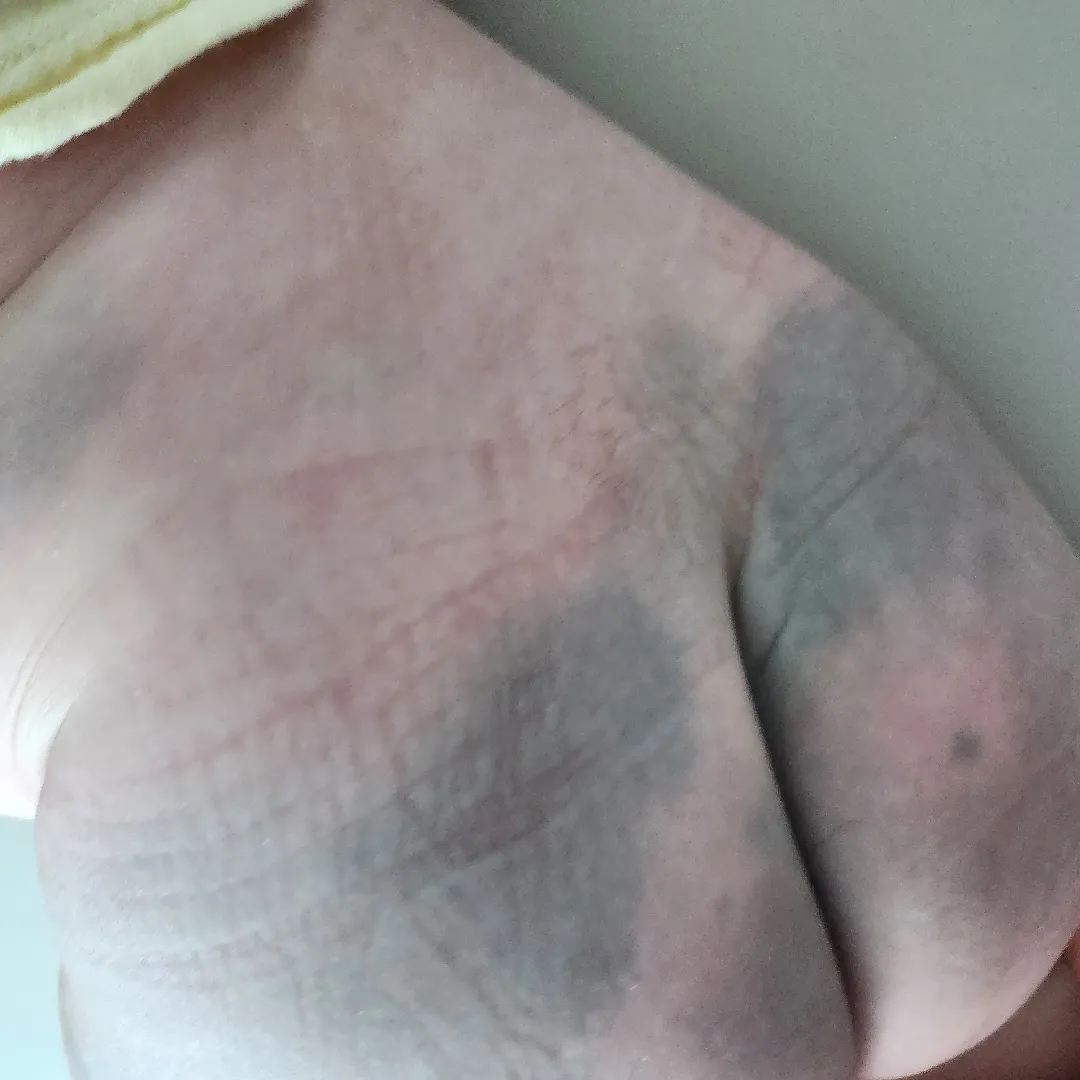 아기 딤플??엉덩이털?(사진+)
